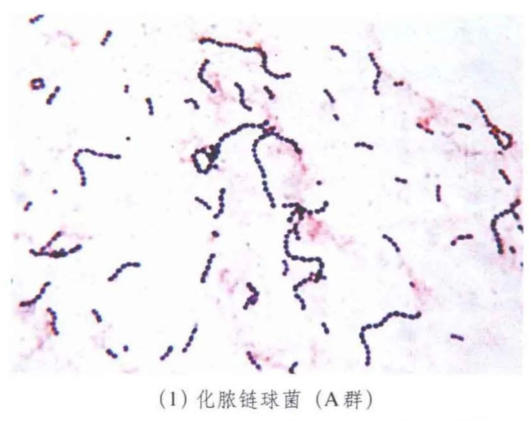 革兰阳性球菌（链球菌属）
