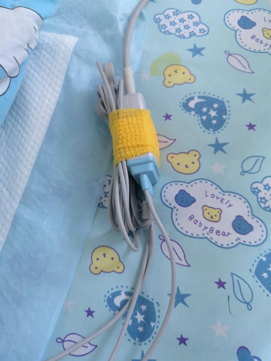 床旁监护仪怎么看ICU坚强卫士---床旁监护仪_https://www.jmylbn.com_新闻资讯_第10张