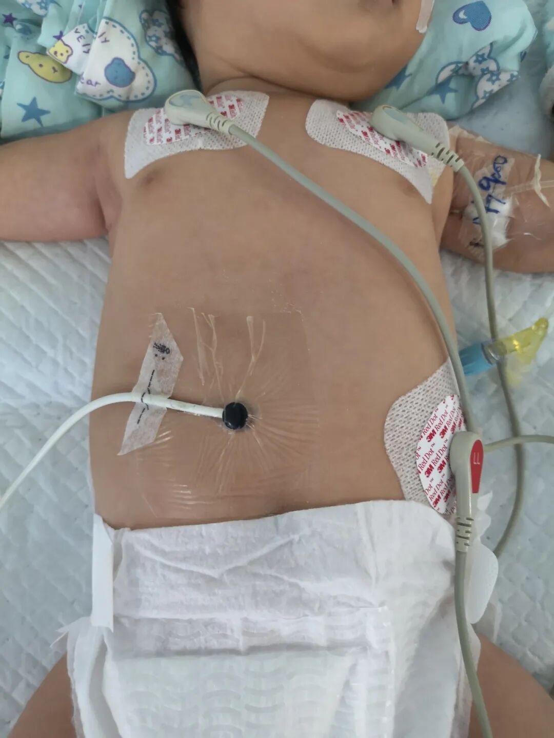 床旁监护仪怎么看ICU坚强卫士---床旁监护仪_https://www.jmylbn.com_新闻资讯_第13张