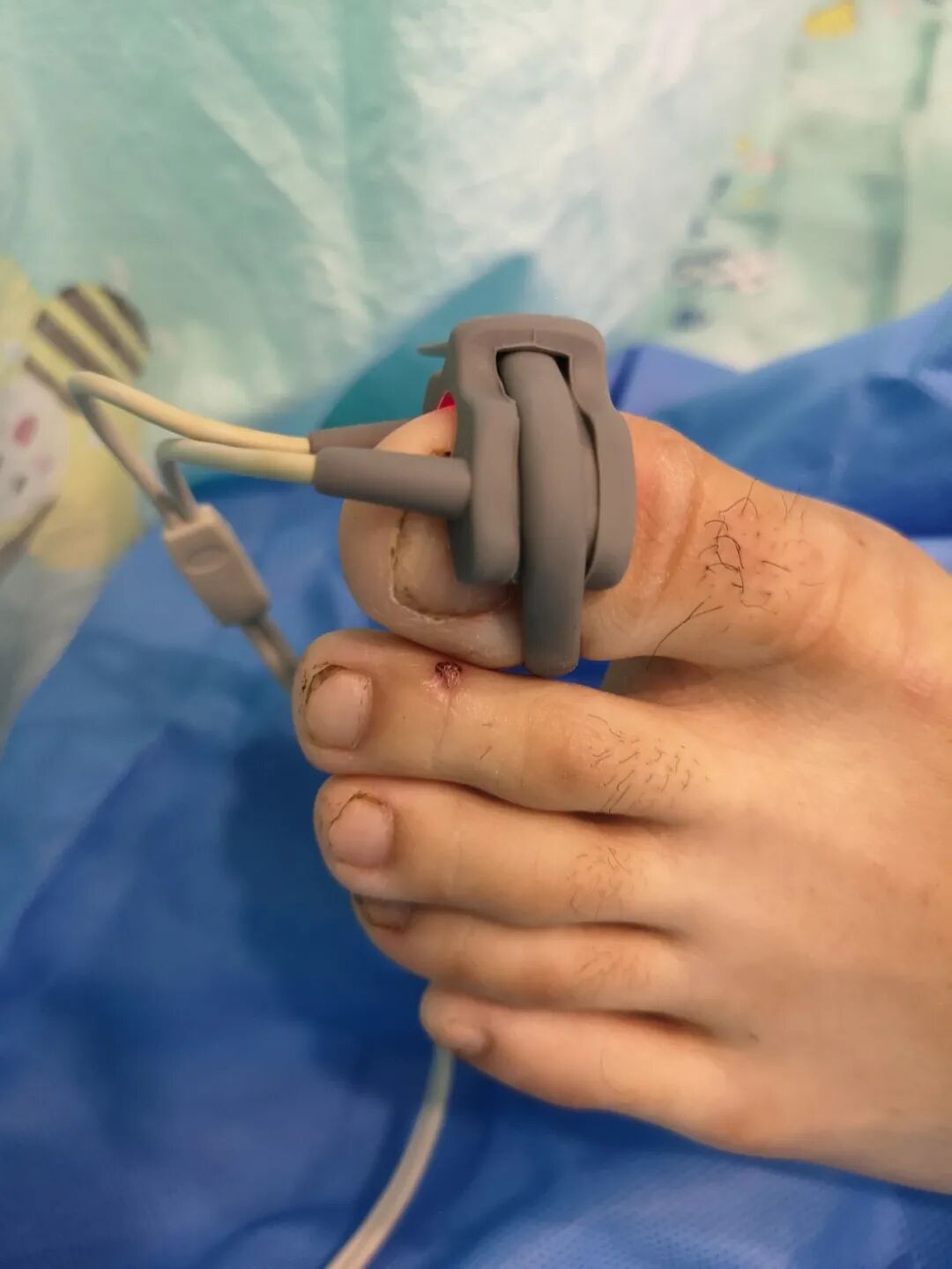 床旁监护仪怎么看ICU坚强卫士---床旁监护仪_https://www.jmylbn.com_新闻资讯_第17张