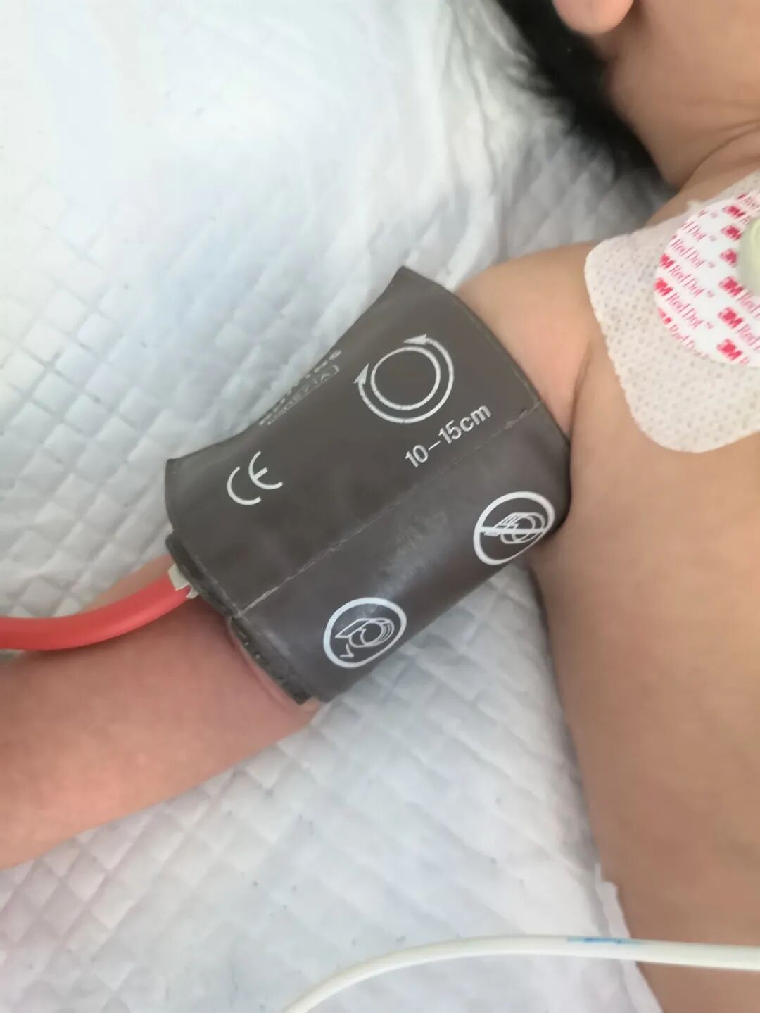 床旁监护仪怎么看ICU坚强卫士---床旁监护仪_https://www.jmylbn.com_新闻资讯_第14张