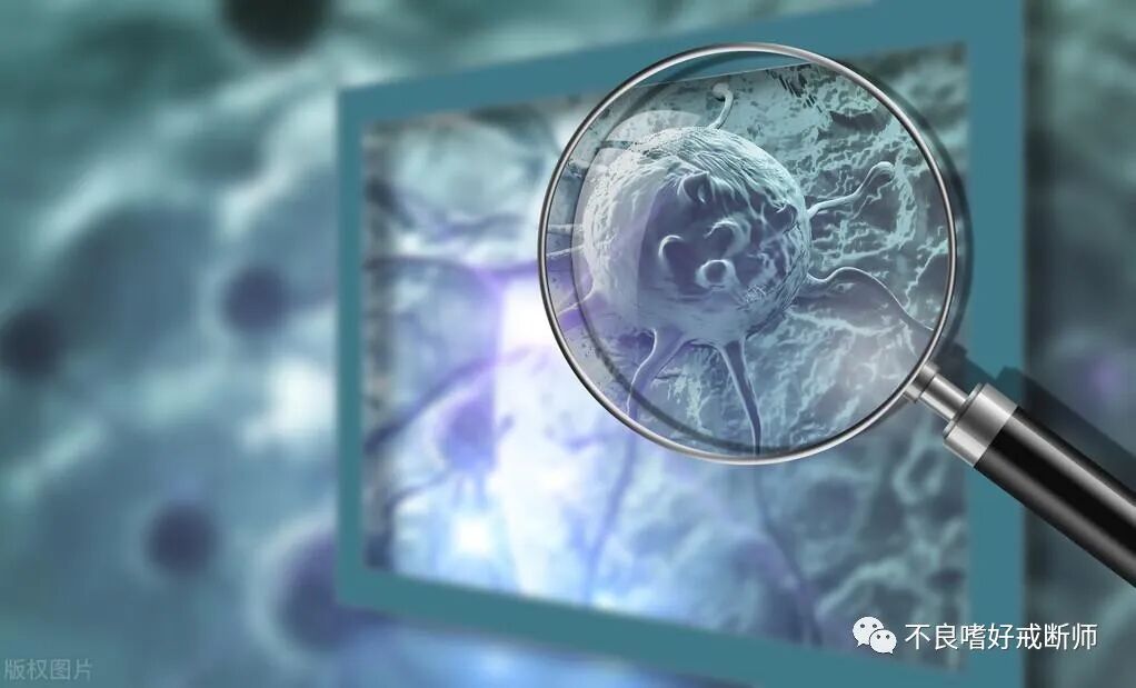 从确诊到死亡只有3个月！四个症状要重视，可能是胰腺癌的信号