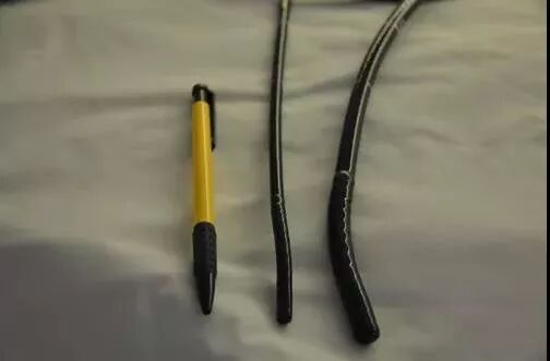 活检钳怎么消毒平常做的胃肠镜检查是如何消毒的？_https://www.jmylbn.com_新闻资讯_第8张