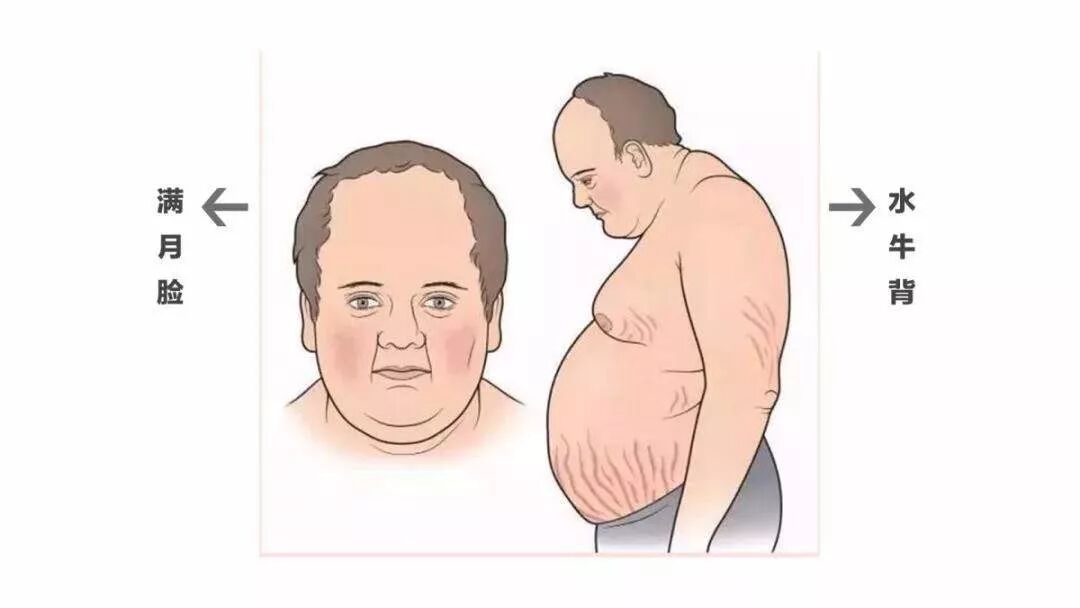 只要用了激素就会变满月脸水牛背