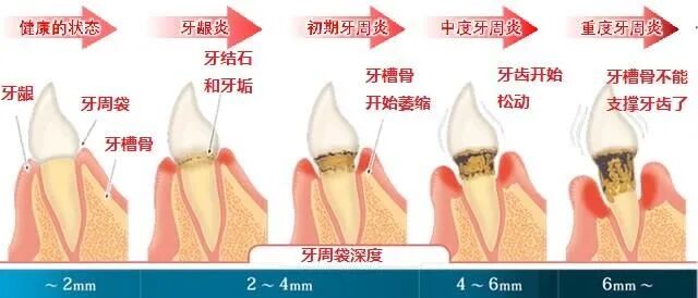 电刀怎么洗我以为只要洗个牙，医生你怎么还拿起了手术刀？_https://www.jmylbn.com_新闻资讯_第2张