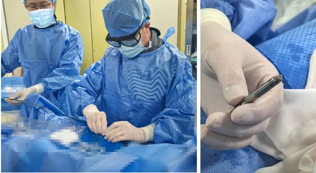 心脏是怎么固定的“螺旋固定，无线心动”——新型主动螺旋固定式无导线心脏起搏器植入术案例分享_https://www.jmylbn.com_新闻资讯_第1张