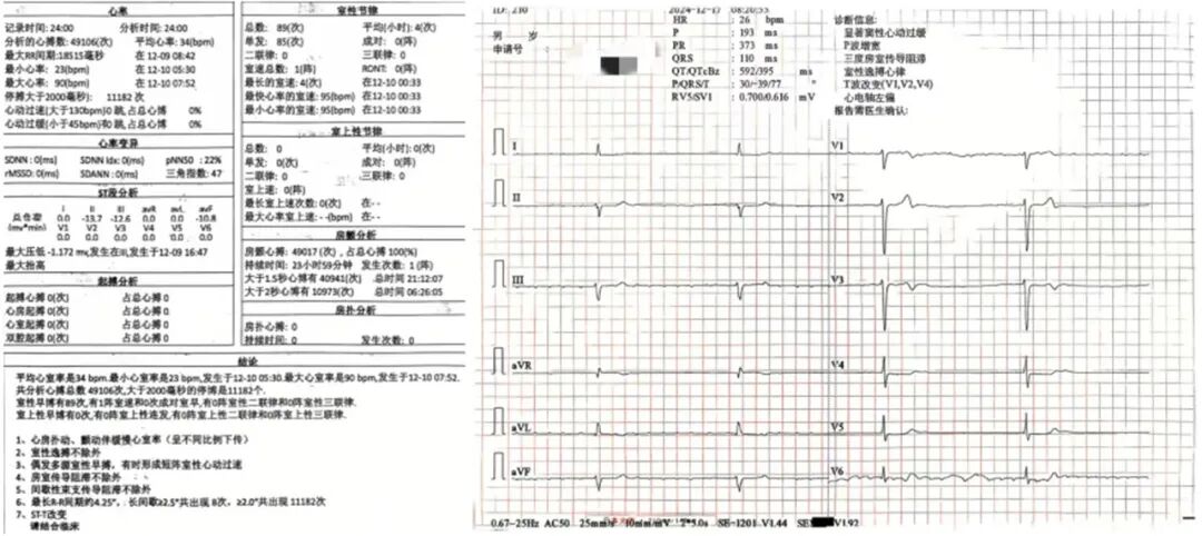 心脏是怎么固定的山西省心血管病医院心内4病区在超声指导下穿刺成功植入 主动螺旋固定式无导线心脏起搏器_https://www.jmylbn.com_新闻资讯_第4张