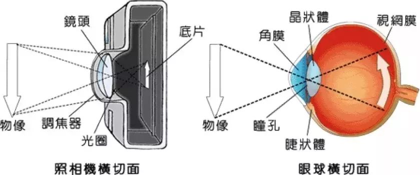 【近视防控】近视形成的原因