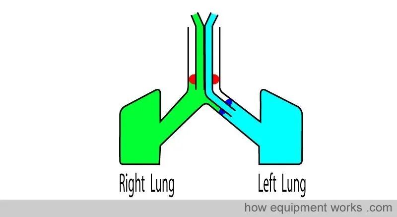气管插管的管是什么气管插管的作用是什么？_https://www.jmylbn.com_新闻资讯_第32张