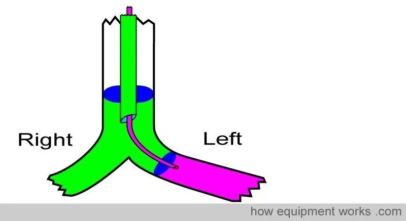 气管插管的管是什么气管插管的作用是什么？_https://www.jmylbn.com_新闻资讯_第39张