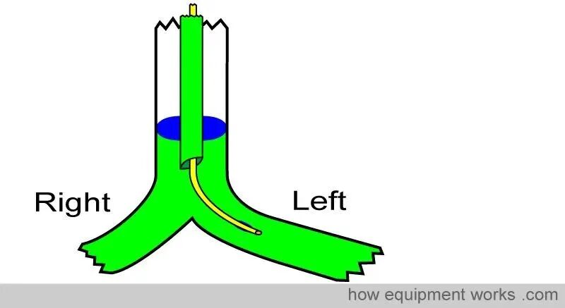 气管插管的管是什么气管插管的作用是什么？_https://www.jmylbn.com_新闻资讯_第38张