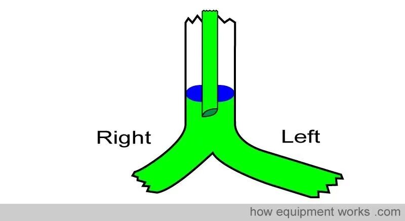 气管插管的管是什么气管插管的作用是什么？_https://www.jmylbn.com_新闻资讯_第37张