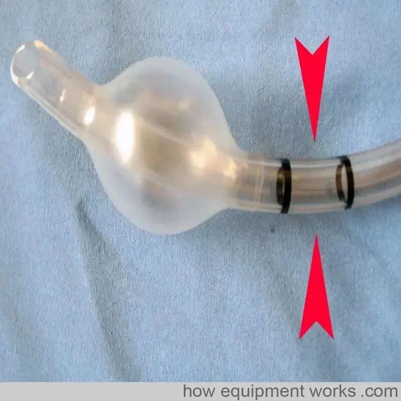 气管插管的管是什么气管插管的作用是什么？_https://www.jmylbn.com_新闻资讯_第8张