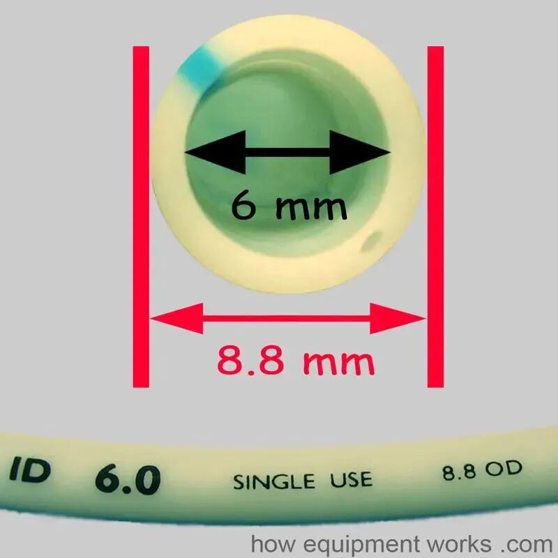 气管插管的管是什么气管插管的作用是什么？_https://www.jmylbn.com_新闻资讯_第4张