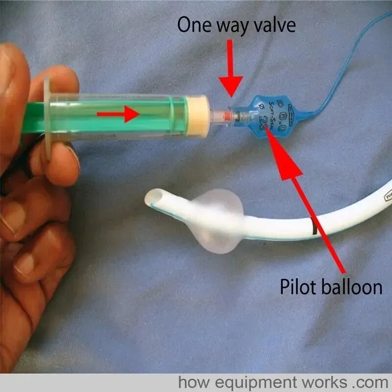 气管插管的管是什么气管插管的作用是什么？_https://www.jmylbn.com_新闻资讯_第14张
