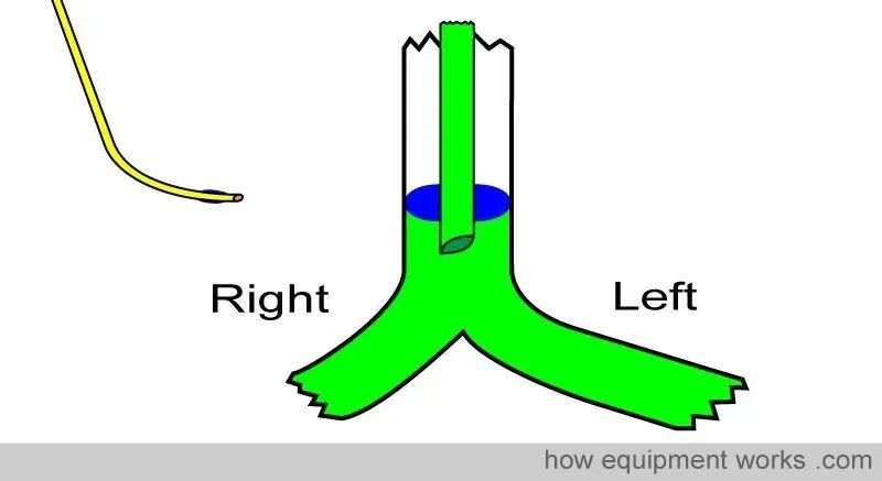 气管插管的管是什么气管插管的作用是什么？_https://www.jmylbn.com_新闻资讯_第40张