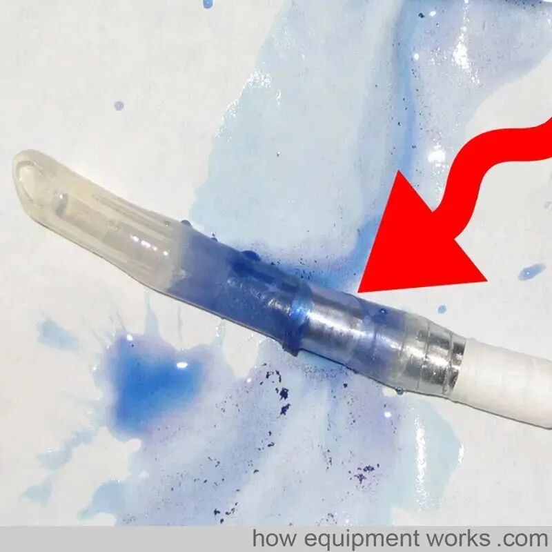 气管插管的管是什么气管插管的作用是什么？_https://www.jmylbn.com_新闻资讯_第31张