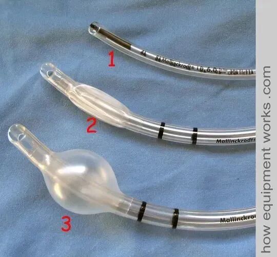 气管插管的管是什么气管插管的作用是什么？_https://www.jmylbn.com_新闻资讯_第12张