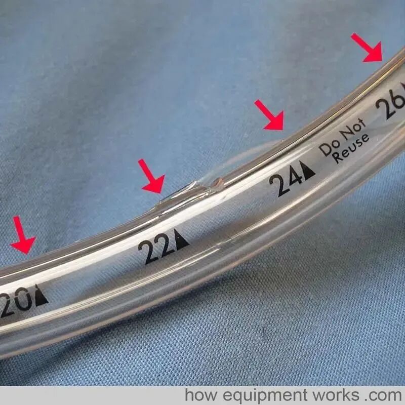 气管插管的管是什么气管插管的作用是什么？_https://www.jmylbn.com_新闻资讯_第5张