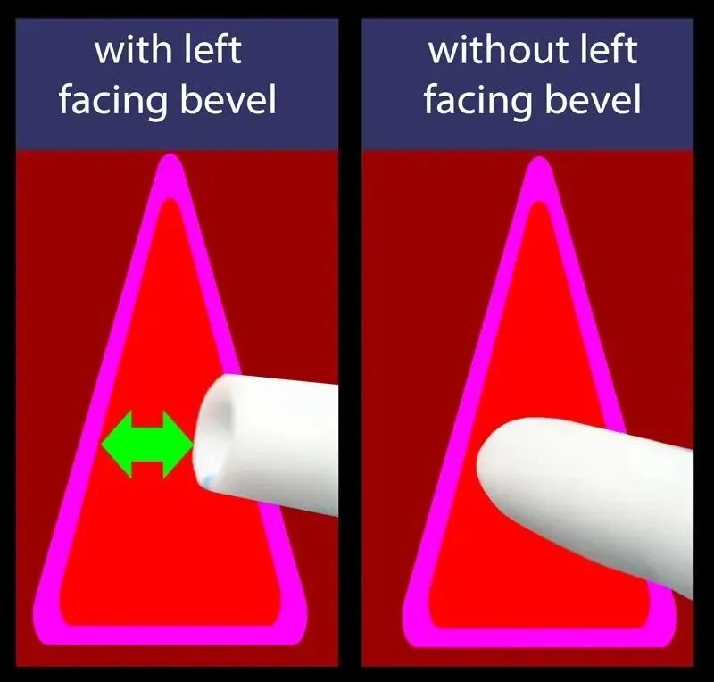 气管插管的管是什么气管插管的作用是什么？_https://www.jmylbn.com_新闻资讯_第10张