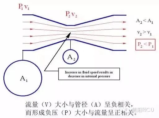 氧浓度怎么调节文丘里面罩，是这样的！_https://www.jmylbn.com_新闻资讯_第2张