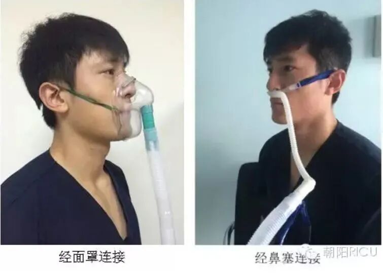 氧浓度怎么调节文丘里面罩，是这样的！_https://www.jmylbn.com_新闻资讯_第15张