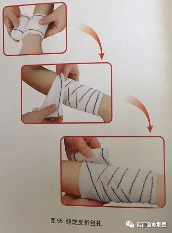 上肢夹板怎么用各种常见创伤急救措施，一文总结！_https://www.jmylbn.com_新闻资讯_第20张