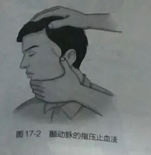 上肢夹板怎么用各种常见创伤急救措施，一文总结！_https://www.jmylbn.com_新闻资讯_第2张