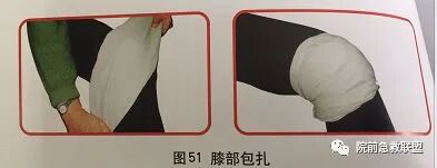 上肢夹板怎么用各种常见创伤急救措施，一文总结！_https://www.jmylbn.com_新闻资讯_第16张