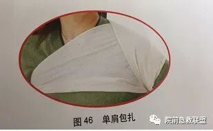 上肢夹板怎么用各种常见创伤急救措施，一文总结！_https://www.jmylbn.com_新闻资讯_第12张