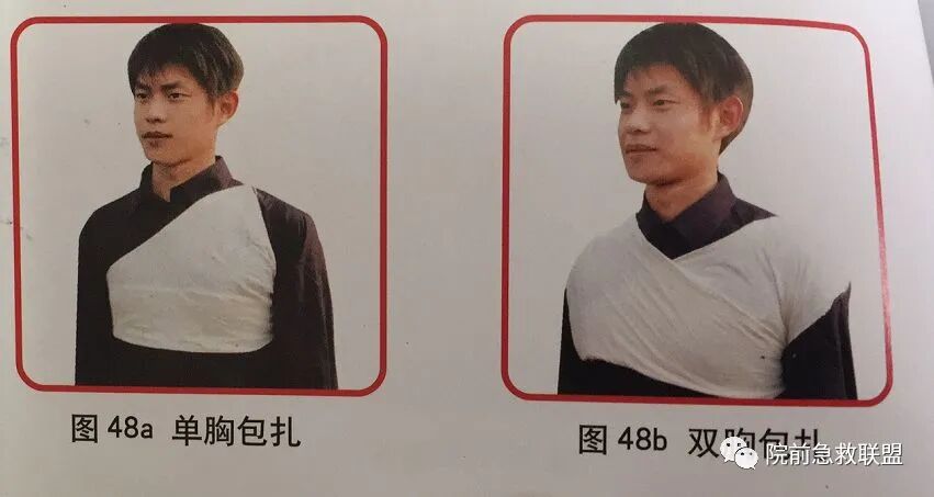 上肢夹板怎么用各种常见创伤急救措施，一文总结！_https://www.jmylbn.com_新闻资讯_第10张