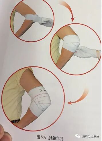 上肢夹板怎么用各种常见创伤急救措施，一文总结！_https://www.jmylbn.com_新闻资讯_第21张