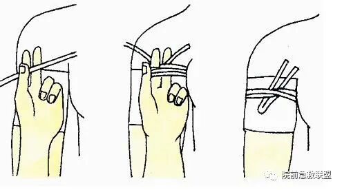 上肢夹板怎么用各种常见创伤急救措施，一文总结！_https://www.jmylbn.com_新闻资讯_第8张