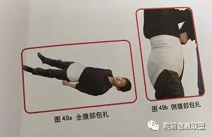 上肢夹板怎么用各种常见创伤急救措施，一文总结！_https://www.jmylbn.com_新闻资讯_第11张