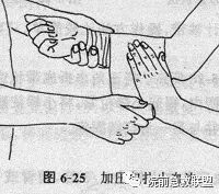 上肢夹板怎么用各种常见创伤急救措施，一文总结！_https://www.jmylbn.com_新闻资讯_第6张