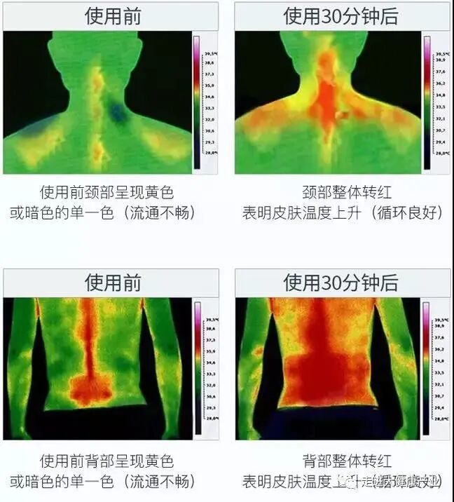 理疗热敷贴怎么贴暖益身草本贴热敷灸疗+草本之力双管齐下，轻松暖宫、袪湿、补阳气！_https://www.jmylbn.com_新闻资讯_第10张