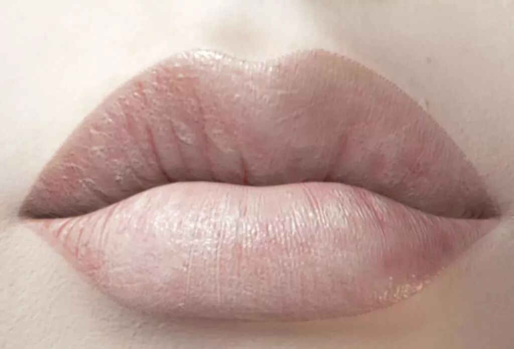 除了先天性的深唇色,也会因为卸妆不彻底,疏于唇部防晒等,导致原本