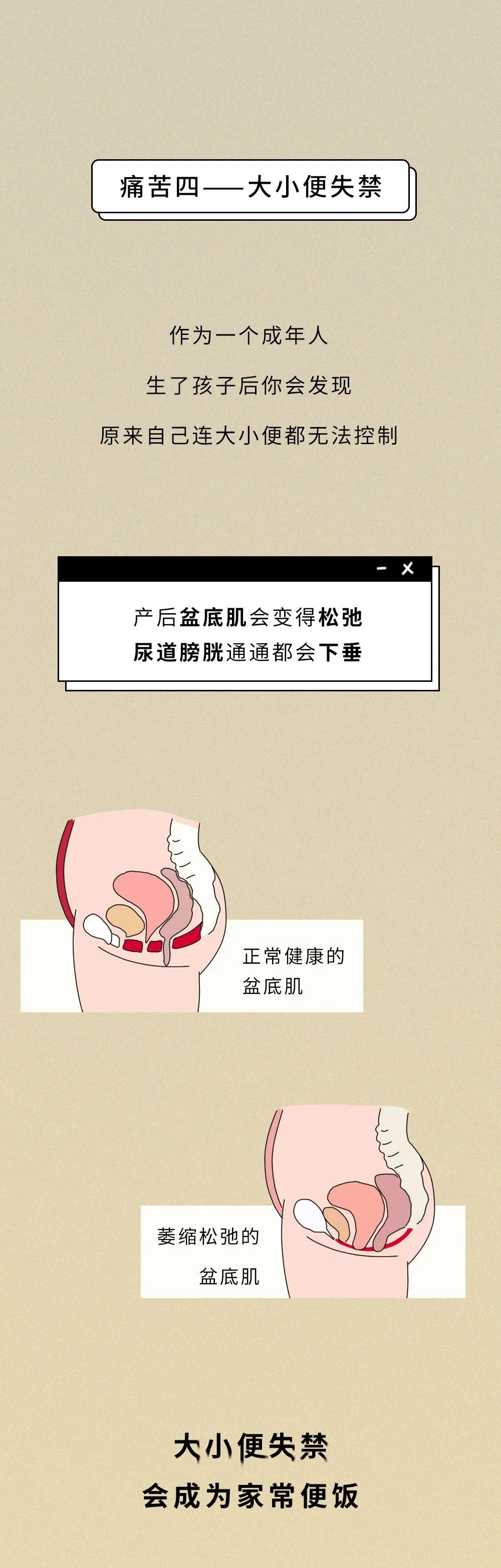 一張圖告訴你生完孩子後還有多少痛苦，沒人能笑著看完…… 親子 第12張