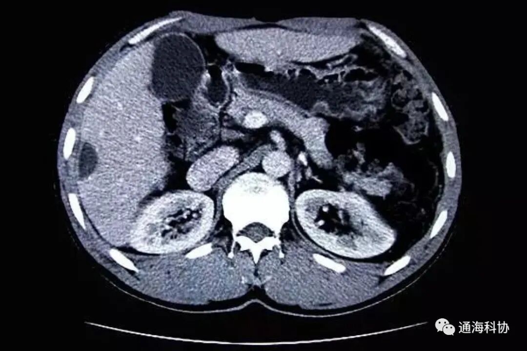 b超md是什么意思ct、核磁、b超有什么区别，工作原理是什么？看完涨知识_https://www.jmylbn.com_新闻资讯_第11张