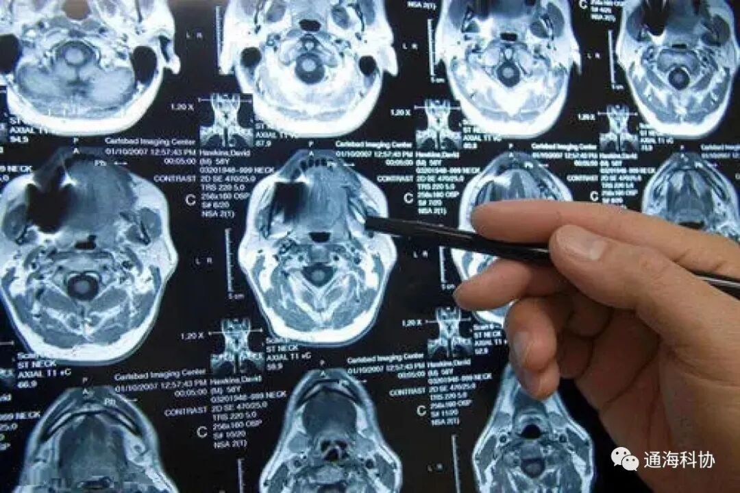 b超md是什么意思ct、核磁、b超有什么区别，工作原理是什么？看完涨知识_https://www.jmylbn.com_新闻资讯_第12张