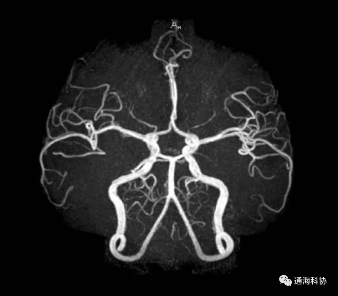 b超md是什么意思ct、核磁、b超有什么区别，工作原理是什么？看完涨知识_https://www.jmylbn.com_新闻资讯_第4张
