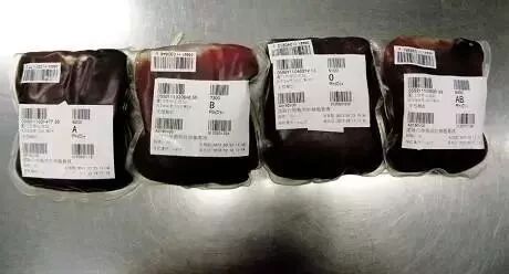 血袋号是什么你知道采血袋上贴的采血序列号有什么作用吗？小小一张贴纸却十分重要！_https://www.jmylbn.com_新闻资讯_第6张