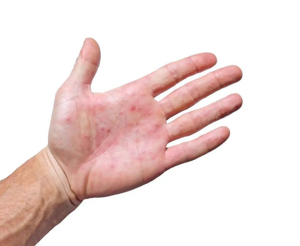 经常放屁是肝脏不好？频繁放屁的人，一般会有这3个习惯