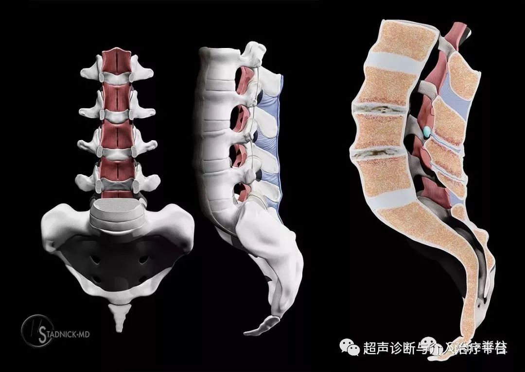 腰痛常见原因：（七）腰椎棘上或棘间韧带炎
