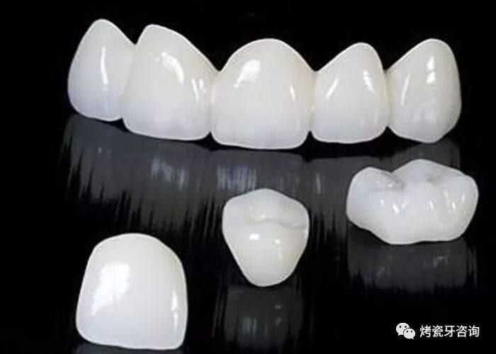 是什么影响了全瓷牙的寿命？