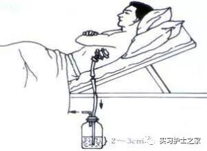 三腔引流管有哪些临床常见引流管_https://www.jmylbn.com_新闻资讯_第4张