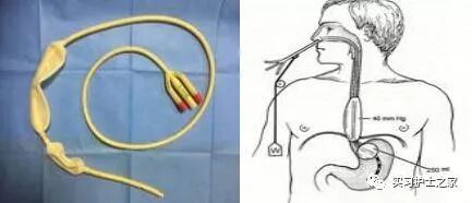 三腔引流管有哪些临床常见引流管_https://www.jmylbn.com_新闻资讯_第7张