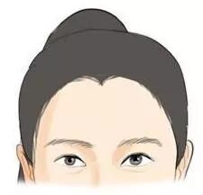 美人尖是假，真相可能是你逐渐后移的发际线！