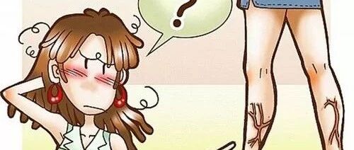 静脉曲张竟藏着致命危险！哪些方法能彻底治愈静脉曲张？