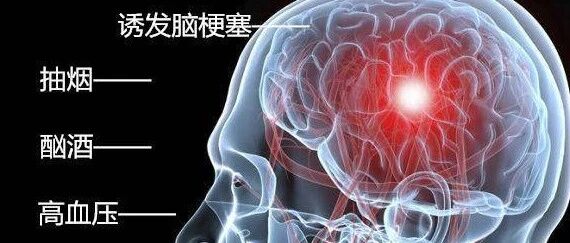 50岁后是脑梗“高发期” 每天1杯茶 摆脱脑梗困扰